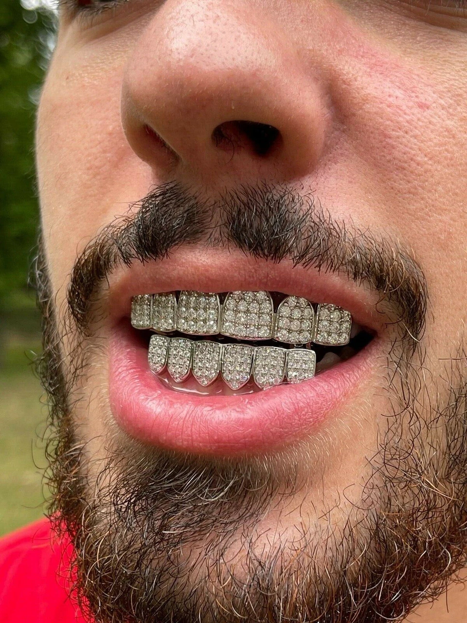 MOISSANITE GRILLZ Pass Diamond Test Teeth Top & Bottom Hip Hop 925 Silver Iced 14 MOISSANITE GRILLZ Pass Diamond Test Teeth Top & Bottom Hip Hop 925 Silver Iced - Image 12