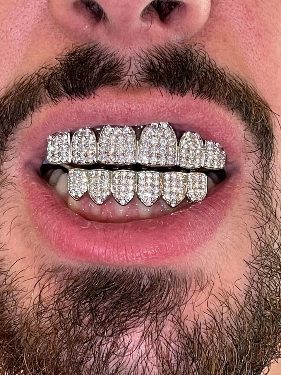 MOISSANITE GRILLZ Pass Diamond Test Teeth Top & Bottom Hip Hop 925 Silver Iced 12 MOISSANITE GRILLZ Pass Diamond Test Teeth Top & Bottom Hip Hop 925 Silver Iced - Image 10