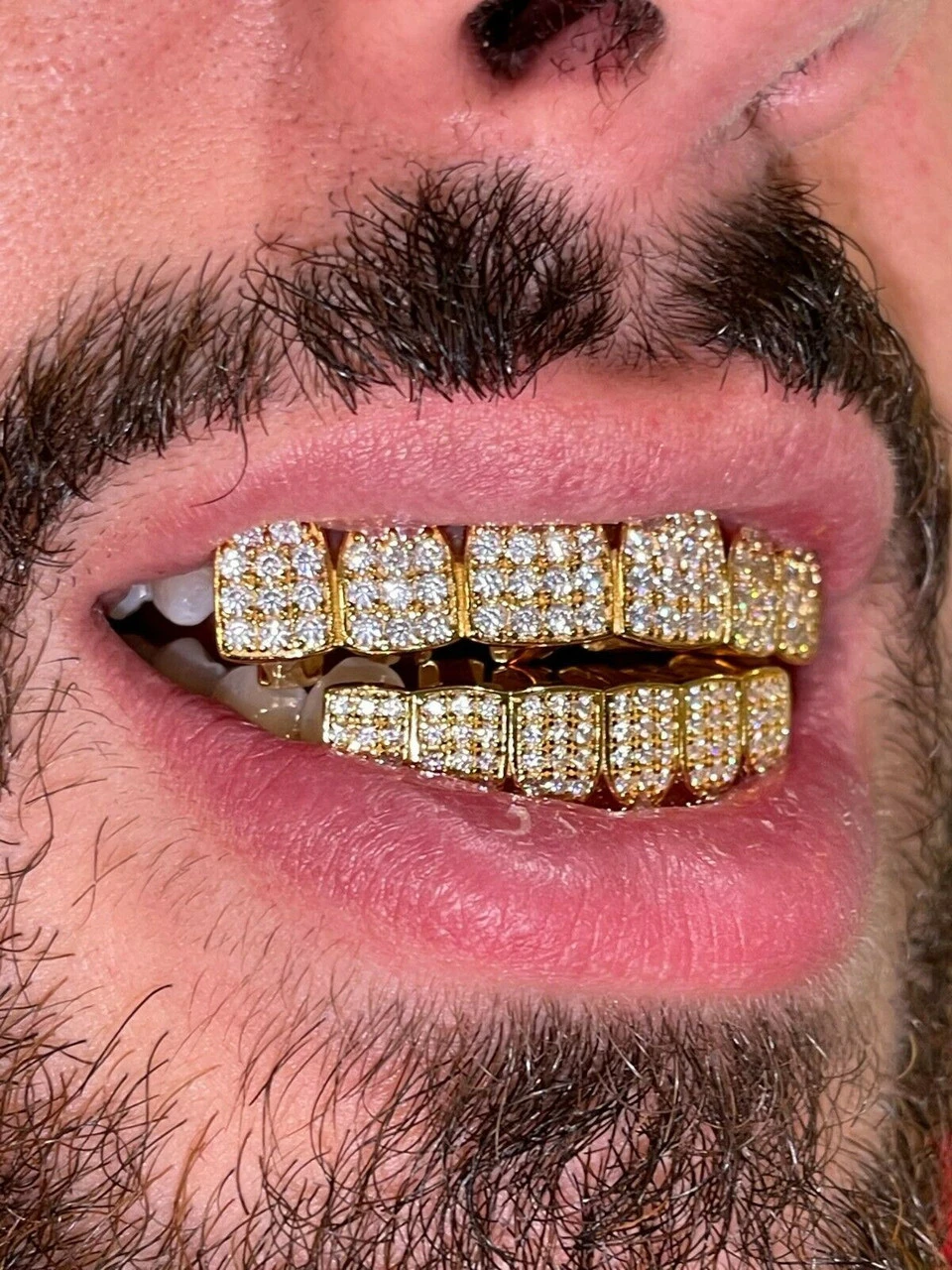 MOISSANITE GRILLZ Pass Diamond Test Teeth Top & Bottom Hip Hop 14k Gold Vermeil 4 MOISSANITE GRILLZ Pass Diamond Test Teeth Top & Bottom Hip Hop 14k Gold Vermeil - Image 2