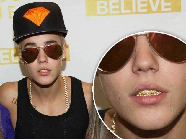 MOISSANITE GRILLZ Pass Diamond Test Teeth Top & Bottom Hip Hop 14k Gold Vermeil 9 MOISSANITE GRILLZ Pass Diamond Test Teeth Top & Bottom Hip Hop 14k Gold Vermeil - Image 7