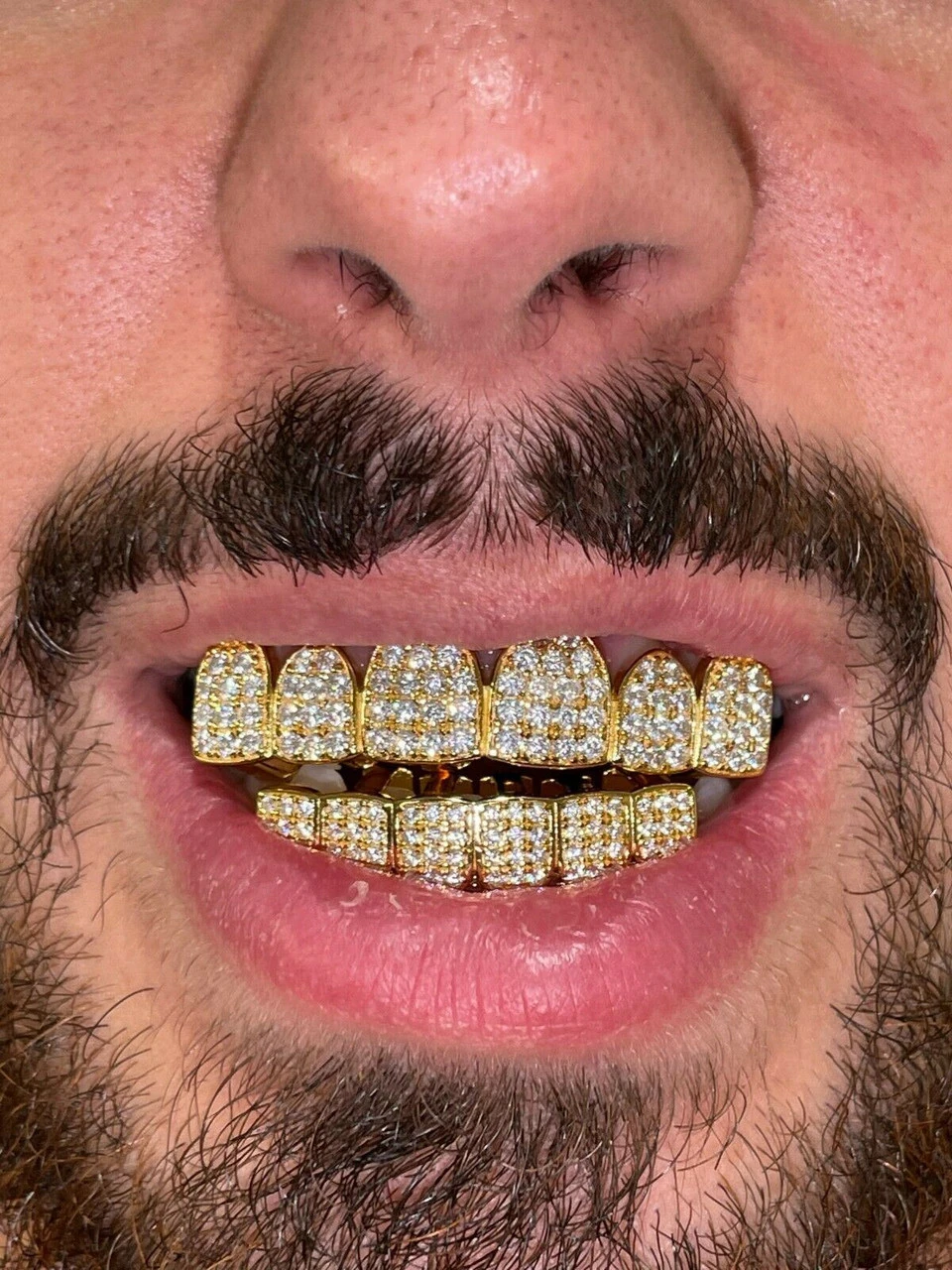 MOISSANITE GRILLZ Pass Diamond Test Teeth Top & Bottom Hip Hop 14k Gold Vermeil 5 MOISSANITE GRILLZ Pass Diamond Test Teeth Top & Bottom Hip Hop 14k Gold Vermeil - Image 3